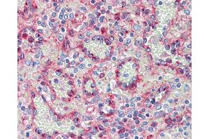 Anti-Fragilis / IFITM3 antibody IHC staining of human spleen. (Fragilis / IFITM3 (AA 1-133) antibody)