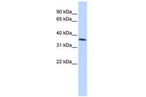 Image no. 1 for anti-Family with Sequence Similarity 164, Member A (FAM164A) (AA 144-193) antibody (ABIN6740284) (FAM164A antibody  (AA 144-193))
