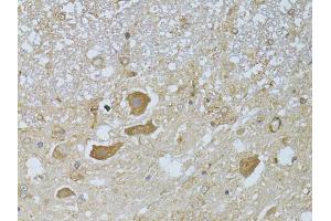Immunohistochemistry of paraffin-embedded rat spinal cord using HDAC8 antibody (ABIN5973443) at dilution of 1/100 (40x lens). (HDAC8 antibody)