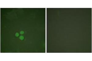 Immunofluorescence analysis of HeLa cells, using DP-1 Antibody.