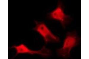 ABIN6274935 staining HeLa by IF/ICC. (CHP antibody  (Internal Region))