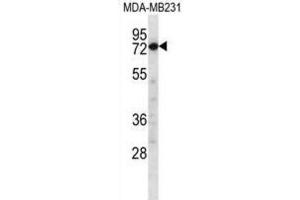 Western Blotting (WB) image for anti-Calpain 8 (CAPN8) antibody (ABIN2997182)