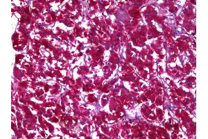 Anti-MDH1 antibody IHC of human adrenal. (MDH1 antibody)