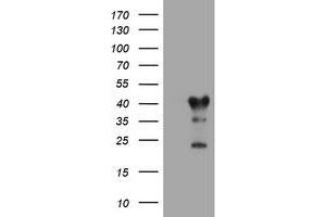 Image no. 1 for anti-Transmembrane Protein 173 (TMEM173) antibody (ABIN1501430) (STING/TMEM173 antibody)