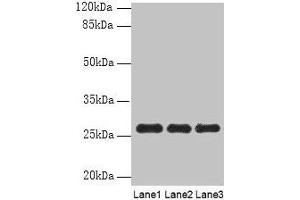Western blot All lanes: PEX11B antibody at 10 μg/mL Lane 1: 293T whole cell lysate Lane 2: Hela whole cell lysate Lane 3: K562 whole cell lysate Secondary Goat polyclonal to rabbit IgG at 1/10000 dilution Predicted band size: 29, 27 kDa Observed band size: 27 kDa (PEX11B antibody  (AA 9-228))