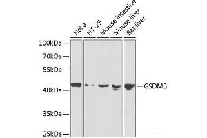 Western blot analysis of extracts of various cell lines using GSDMB Polyclonal Antibody at dilution of 1:1000.