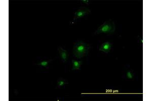 Image no. 2 for anti-RNA Binding Motif Protein 39 (RBM39) (AA 423-473) antibody (ABIN599086) (RBM39 antibody  (AA 423-473))