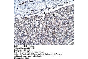 Rabbit Anti-HCLS1 Antibody  Paraffin Embedded Tissue: Human Heart Cellular Data: Myocardial cells Antibody Concentration: 4. (HCLS1 antibody  (N-Term))