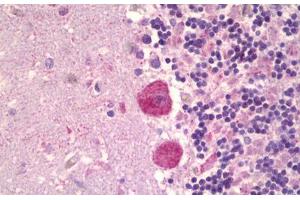 Anti-MAPK15 antibody IHC staining of human brain, cerebellum. (MAPK15 antibody  (AA 1-245))