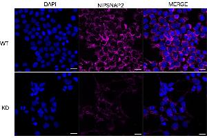 Immunocytochemical staining of HeLa cells using NIPSNAP2 antibody (ABIN7798724), 1:1,000), Top panel: wild-type (WT), Bottom panal: NIPSNAP2 shRNA knockdown (KD).