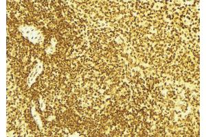 ABIN6269187 at 1/100 staining Mouse spleen tissue by IHC-P. (EIF2AK2 antibody  (Internal Region))