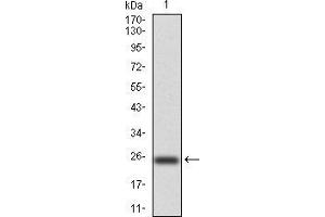 Western Blotting (WB) image for anti-NADPH Oxidase 4 (NOX4) (AA 210-310) antibody (ABIN5872374) (NADPH Oxidase 4 antibody  (AA 210-310))