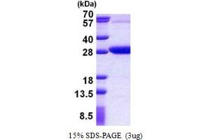 SDS-PAGE (SDS) image for REX2, RNA Exonuclease 2 Homolog (REXO2) (AA 26-237) protein (His tag) (ABIN5853027)