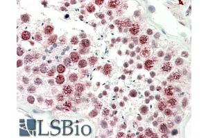 ABIN5539855 (5µg/ml) staining of paraffin embedded Human Testis. (DNAJC5G antibody  (Internal Region))