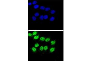 Confocal immunofluorescent analysis of BAG1 Antibody (C-term) (ABIN389451 and ABIN2839520) with Hela cell followed by Alexa Fluor® 488-conjugated goat anti-rabbit lgG (green). (BAG1 antibody  (C-Term))