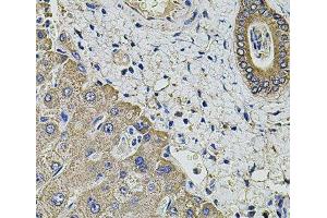 Immunohistochemistry of paraffin-embedded Human liver damage using KCNK9 Polyclonal Antibody at dilution of 1:100 (40x lens). (KCNK9 antibody)