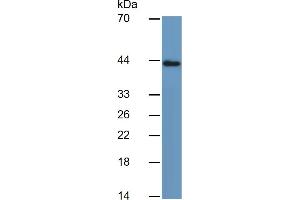 Mouse Capture antibody from the kit in WB with Positive Control: Human Stomach lysate.