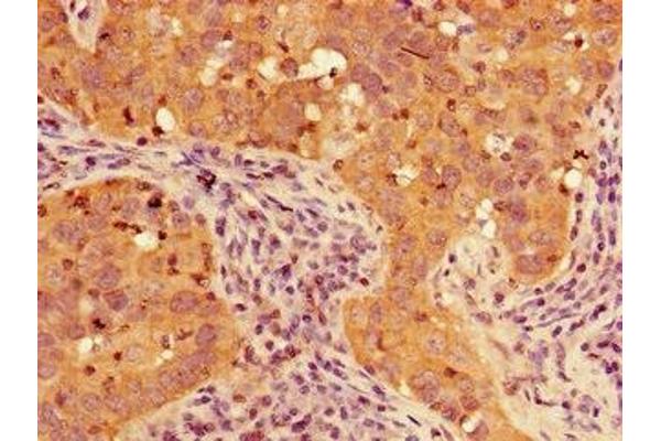 TIGAR antibody  (AA 24-188)