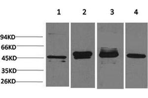 Western Blotting (WB) image for anti-Growth Associated Protein 43 (GAP43) antibody (ABIN5955883) (GAP43 antibody)