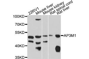 Western blot analysis of extracts of various cell lines, using AP3M1 antibody (ABIN4902920) at 1:1000 dilution. (AP3M1 antibody)