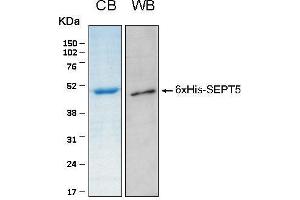 10% SDS-PAGE stained with Coomassie Blue (CB), immunobloting with anti-6xHis (WB) serum and peptide fingerprinting by MALDI-TOF-TOF mass spectrometry