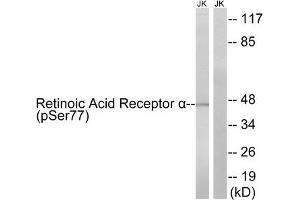 Western blot analysis of extracts from Jurkat cells treated with PMA (125 ng/mL, 30 mins), using Retinoic Acid Receptor α(Phospho-Ser77) antibody. (Retinoic Acid Receptor alpha antibody  (pSer77))