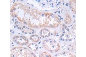 IHC-P analysis of Kidney tissue, with DAB staining. (CXCL12 antibody  (AA 23-89))
