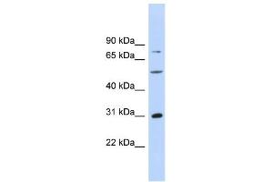 WB Suggested Anti-ASPH Antibody Titration: 0. (Aspartate beta Hydroxylase antibody  (Middle Region))