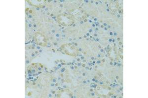 Immunohistochemistry of paraffin-embedded rat kidney using PHOX2B antibody (ABIN5995873) at dilution of 1/100 (40x lens). (PHOX2B antibody)