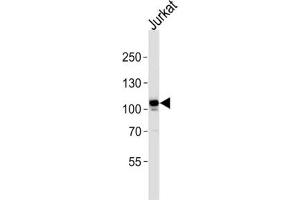 Western Blotting (WB) image for anti-C-Mer Proto-Oncogene Tyrosine Kinase (MERTK) antibody (ABIN3003537)