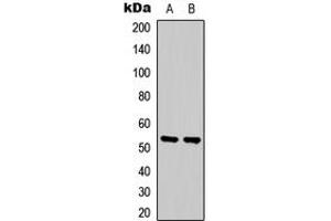 Western blot analysis of SGK1 expression in Jurkat (A), HepG2 (B) whole cell lysates.