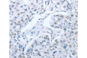 Immunohistochemistry (IHC) image for anti-rho/rac Guanine Nucleotide Exchange Factor (GEF) 2 (ARHGEF2) antibody (ABIN2429249) (ARHGEF2 antibody)