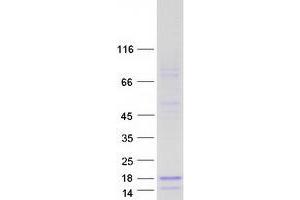 Validation with Western Blot (SPINT4 Protein (Myc-DYKDDDDK Tag))