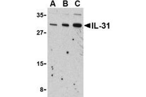 Western blot analysis of IL-31 in RAW264. (IL-31 antibody  (N-Term))