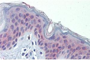 Human Skin (formalin-fixed, paraffin-embedded) stained with POLDIP3 antibody ABIN462229 followed by biotinylated goat anti-rabbit IgG secondary antibody ABIN481713, alkaline phosphatase-streptavidin and chromogen. (POLDIP3 antibody  (AA 326-375))