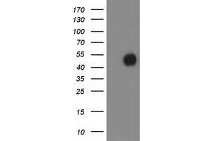 HEK293T cells were transfected with the pCMV6-ENTRY control (Left lane) or pCMV6-ENTRY MEF2C (Right lane) cDNA for 48 hrs and lysed. (MEF2C antibody)
