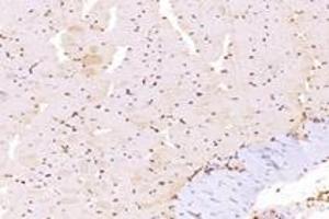Immunohistochemistry analysis of paraffin-embedded mouse muscle using,TBX10 (ABIN7075814) at dilution of 1: 4600 (T-Box 10 antibody)