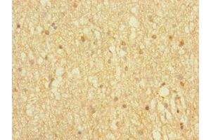 Immunohistochemistry of paraffin-embedded human brain tissue using ABIN7155885 at dilution of 1:100 (HOMER3 antibody  (AA 151-361))