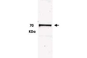 Western blot using Ubash3b polyclonal antibody  shows detection of a band ~70 kDa correspondingto mouse Ubash3b. (UBASH3B antibody  (C-Term))