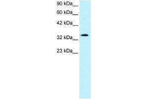 WB Suggested Anti-PAWR Antibody Titration:  0. (PAWR antibody  (Middle Region))