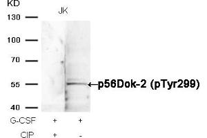Western blot analysis of extracts from JK cells, treated with G-CSF or calf intestinal phosphatase (CIP), using p56Dok-2 (Phospho-Tyr299) Antibody. (DOK2 antibody  (pTyr299))