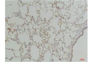 Immunohistochemistry (IHC) analysis of paraffin-embedded Rat LungTissue using Endothelin B ReceptorRabbit Polyclonal Antibody diluted at 1:200. (EDNRB antibody)