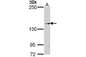 WB Image Sample (30 ug of whole cell lysate) A: Hep G2 , 7. (TRPM2 antibody  (N-Term))
