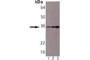 Western blot analysis of Syntaxin 6: Lane 1: CHO-K1, Lane 2: Mouse Brain, Lane 3: Rat Brain. (Syntaxin 6 antibody)