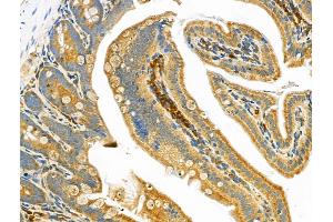 ABIN6262622 and ABIN6268657 at 1/100 staining Mouse colorectal tissue by IHC-P.