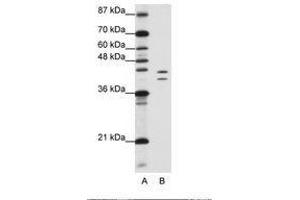 Image no. 2 for anti-Heterogeneous Nuclear Ribonucleoprotein D (HNRNPD) (AA 61-110) antibody (ABIN203267)