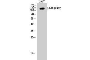 Western Blot analysis of 293T cells with Phospho-FAK (Tyr397) Polyclonal Antibody at dilution of 1:1000 (FAK antibody  (pTyr397))