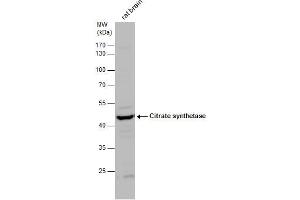 WB Image Citrate synthetase antibody detects Citrate synthetase protein by western blot analysis. (CS antibody)