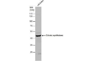 WB Image Citrate synthetase antibody detects Citrate synthetase protein by western blot analysis.