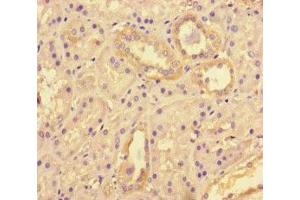 Immunohistochemistry of paraffin-embedded human kidney tissue using ABIN7171500 at dilution of 1:100 (TNKS2 antibody  (AA 1-246))